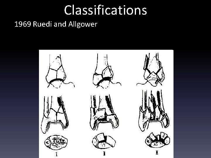 Classifications 1969 Ruedi and Allgower 