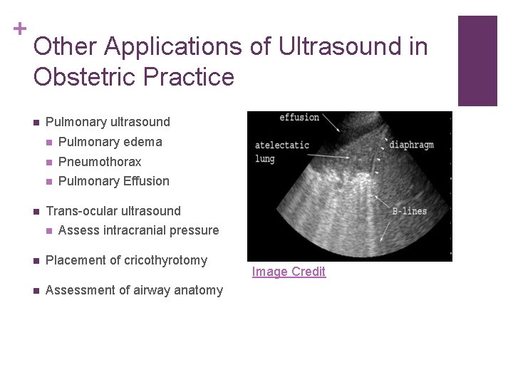 + Other Applications of Ultrasound in Obstetric Practice n n Pulmonary ultrasound n Pulmonary