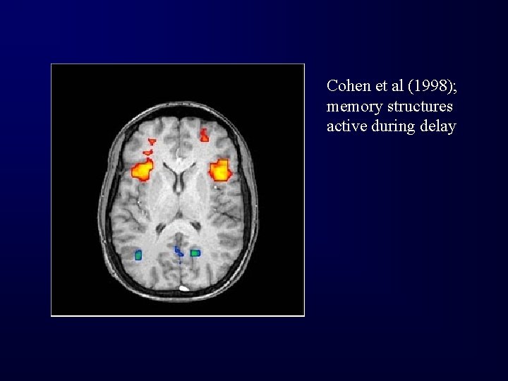 Cohen et al (1998); memory structures active during delay 