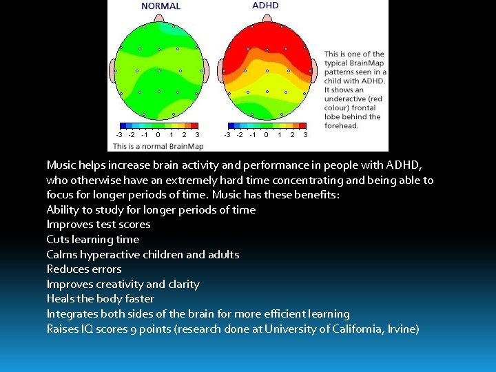 Music helps increase brain activity and performance in people with ADHD, who otherwise have