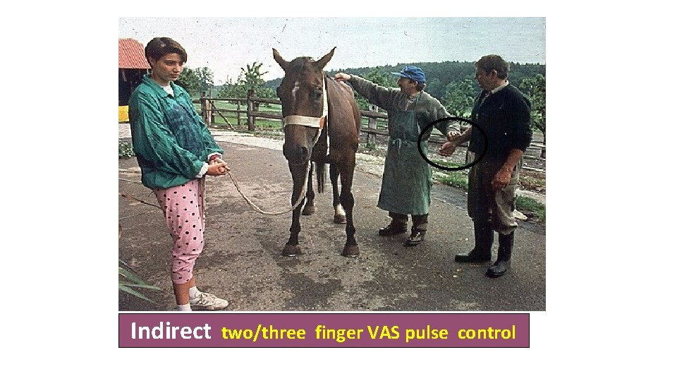 Indirect two/three finger VAS pulse control 