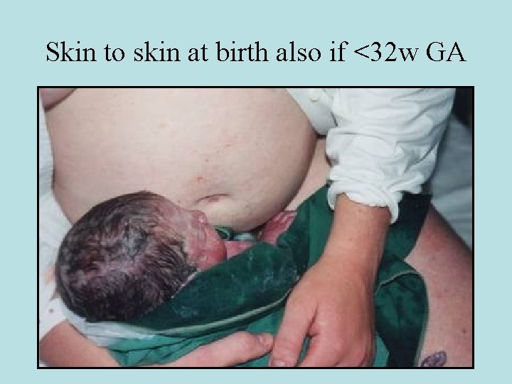 Skin to skin at birth also if <32 w GA 