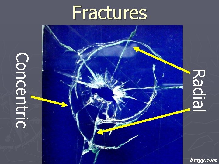 Fractures Radial Concentric bsapp. com 