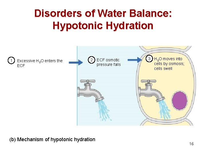 Disorders of Water Balance: Hypotonic Hydration 1 Excessive H 2 O enters the ECF