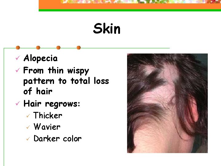 Skin ü ü ü Alopecia From thin wispy pattern to total loss of hair