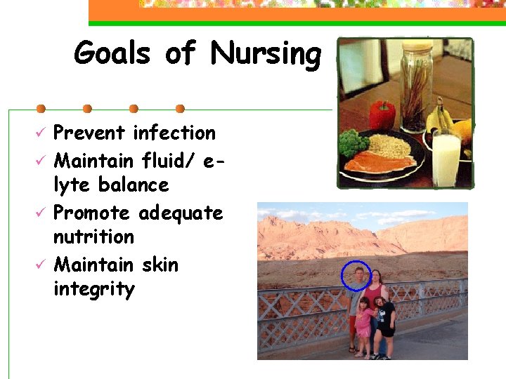 Goals of Nursing ü ü Prevent infection Maintain fluid/ elyte balance Promote adequate nutrition