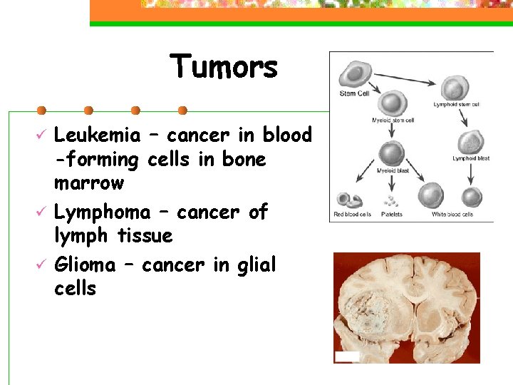 Tumors ü ü ü Leukemia – cancer in blood -forming cells in bone marrow