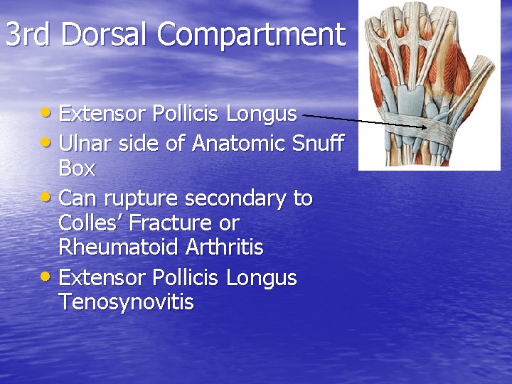3 rd Dorsal Compartment • Extensor Pollicis Longus • Ulnar side of Anatomic Snuff