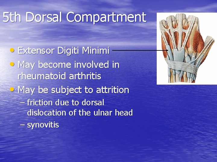 5 th Dorsal Compartment • Extensor Digiti Minimi • May become involved in rheumatoid