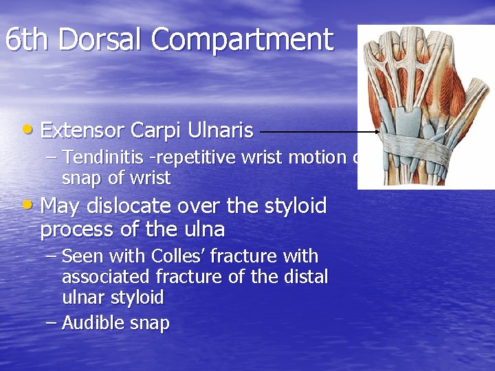 6 th Dorsal Compartment • Extensor Carpi Ulnaris – Tendinitis -repetitive wrist motion or