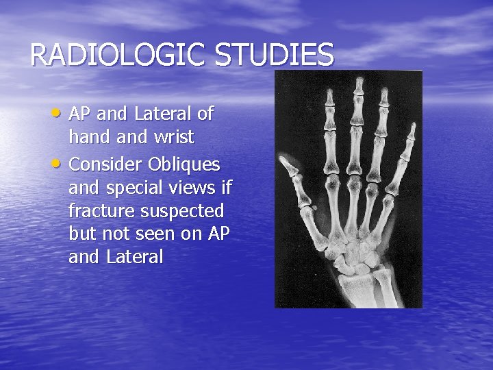 RADIOLOGIC STUDIES • AP and Lateral of • hand wrist Consider Obliques and special