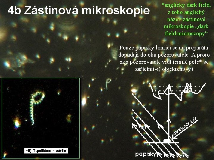 4 b Zástinová mikroskopie *anglicky dark field, z toho anglický název zástinové mikroskopie „dark