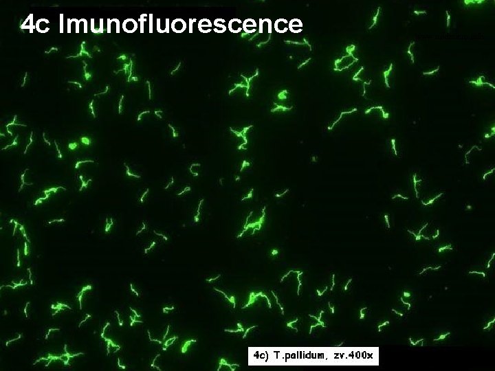 4 c Imunofluorescence www. medmicro. info 