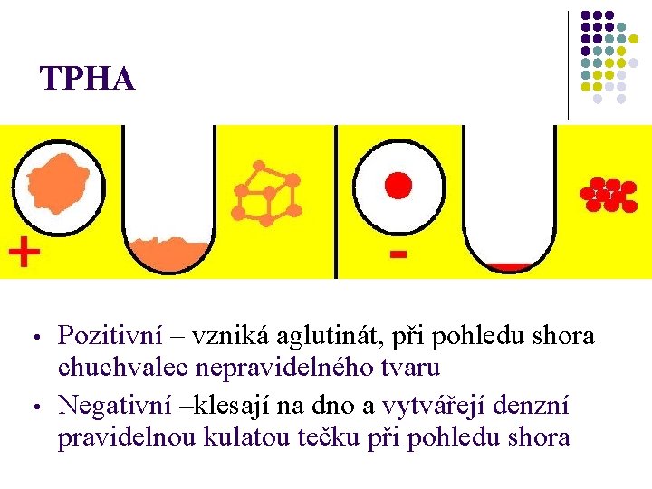 TPHA • • Pozitivní – vzniká aglutinát, při pohledu shora chuchvalec nepravidelného tvaru Negativní