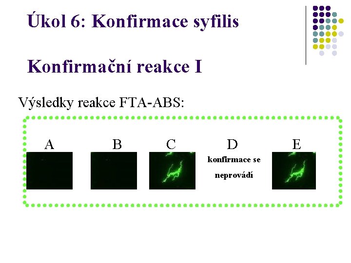 Úkol 6: Konfirmace syfilis Konfirmační reakce I Výsledky reakce FTA-ABS: A B C D