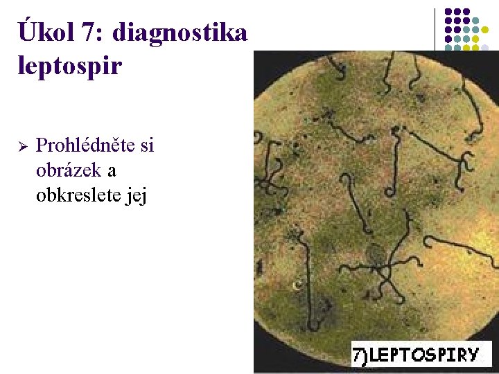 Úkol 7: diagnostika leptospir Ø Prohlédněte si obrázek a obkreslete jej 