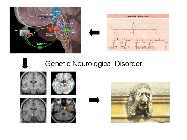 Genetic Neurological Disorder 