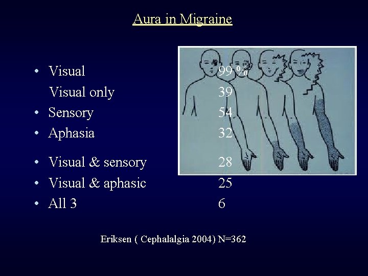 Aura in Migraine • Visual only • Sensory • Aphasia 99 % 39 54