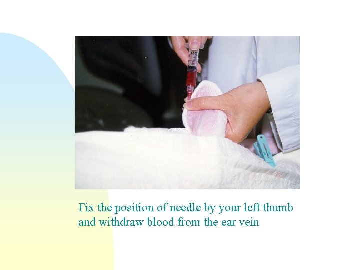 Fix the position of needle by your left thumb and withdraw blood from the