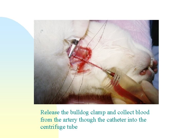 Release the bulldog clamp and collect blood from the artery though the catheter into