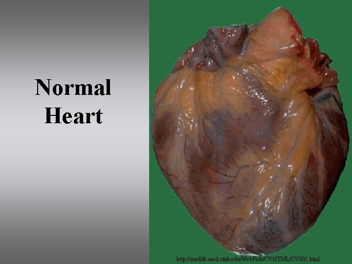 Normal Heart http: //medlib. med. utah. edu/Web. Path/CVHTML/CV 001. html 