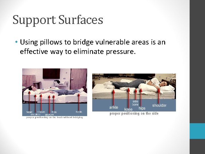 Support Surfaces • Using pillows to bridge vulnerable areas is an effective way to Support Surfaces • Using pillows to bridge vulnerable areas is an effective way to