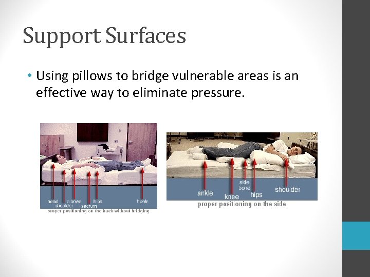 Support Surfaces • Using pillows to bridge vulnerable areas is an effective way to