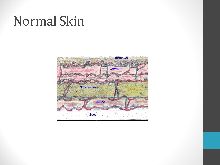 Normal Skin 