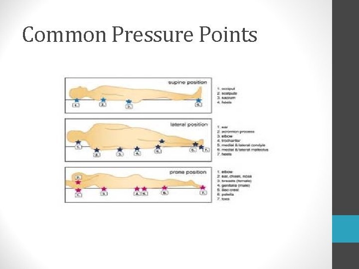 Common Pressure Points 