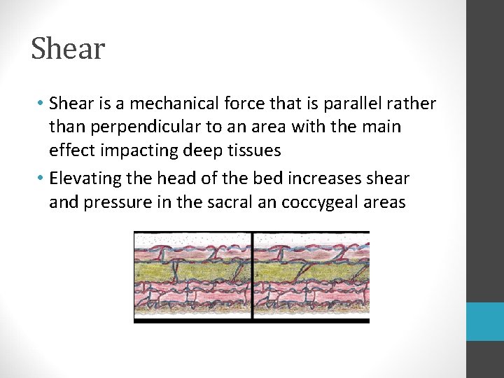 Shear • Shear is a mechanical force that is parallel rather than perpendicular to Shear • Shear is a mechanical force that is parallel rather than perpendicular to