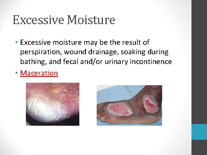Excessive Moisture • Excessive moisture may be the result of perspiration, wound drainage, soaking Excessive Moisture • Excessive moisture may be the result of perspiration, wound drainage, soaking