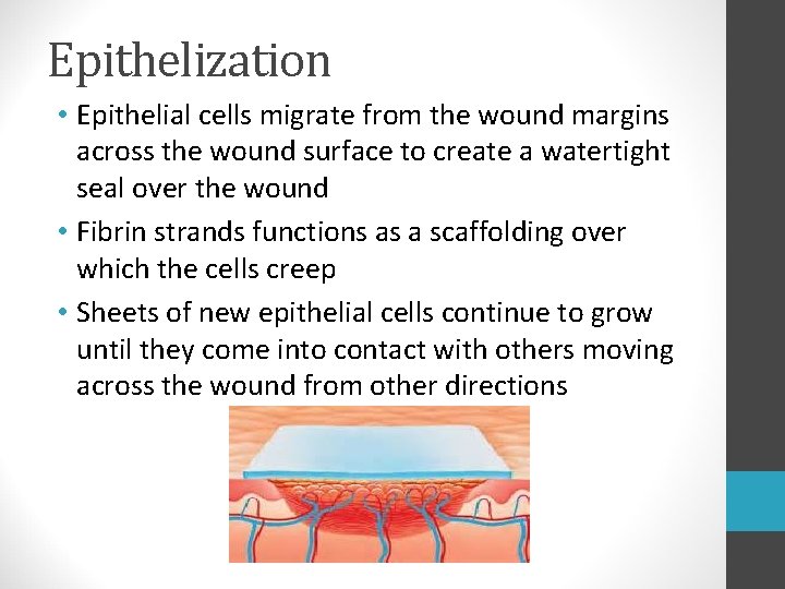 Epithelization • Epithelial cells migrate from the wound margins across the wound surface to Epithelization • Epithelial cells migrate from the wound margins across the wound surface to