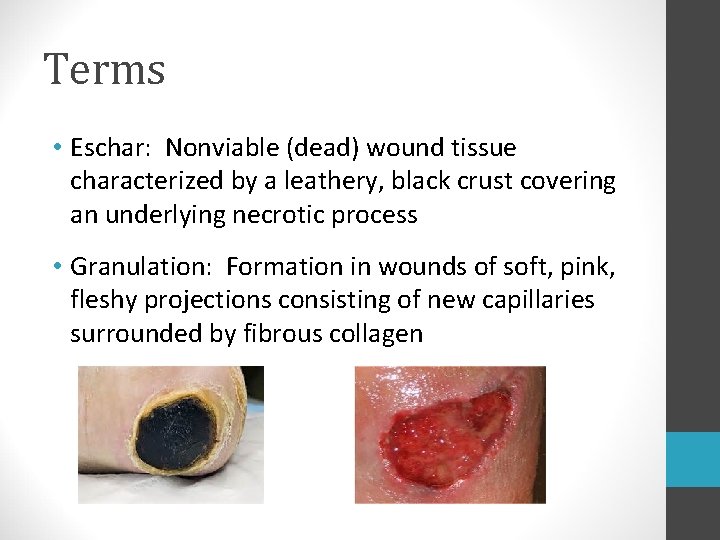 Terms • Eschar: Nonviable (dead) wound tissue characterized by a leathery, black crust covering