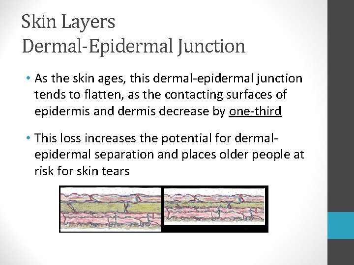 Skin Layers Dermal-Epidermal Junction • As the skin ages, this dermal-epidermal junction tends to