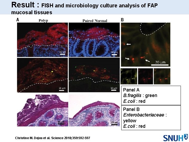 Result : FISH and microbiology culture analysis of FAP mucosal tissues Panel A B.