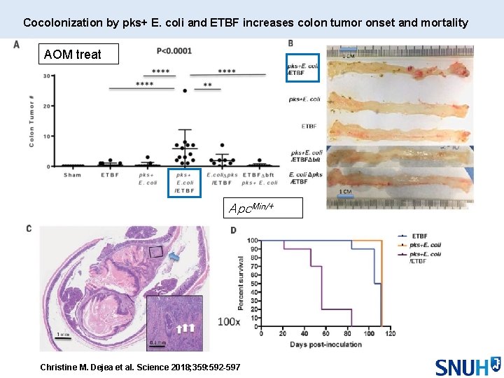 Cocolonization by pks+ E. coli and ETBF increases colon tumor onset and mortality AOM