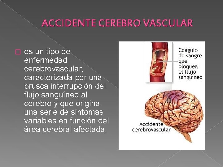 ACCIDENTE CEREBRO VASCULAR � es un tipo de enfermedad cerebrovascular, caracterizada por una brusca