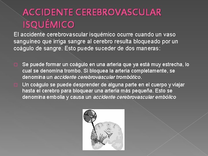 ACCIDENTE CEREBROVASCULAR ISQUÉMICO El accidente cerebrovascular isquémico ocurre cuando un vaso sanguíneo que irriga