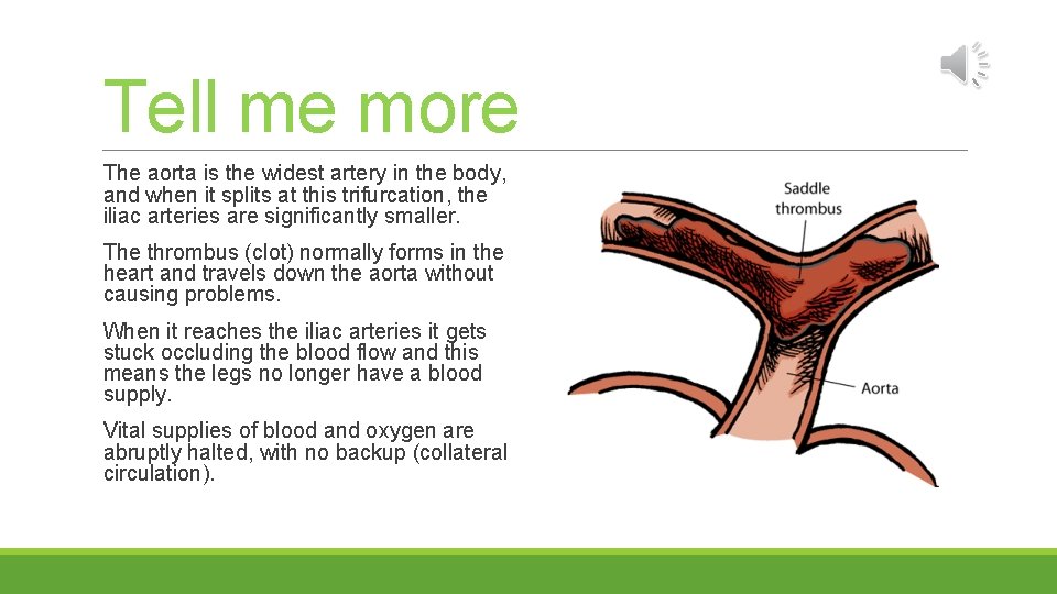 Tell me more The aorta is the widest artery in the body, and when