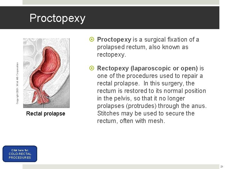 Proctopexy Copyright 2001, Web MD Corporation Proctopexy is a surgical fixation of a prolapsed