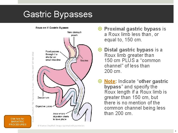 Gastric Bypasses Proximal gastric bypass is a Roux limb less than, or equal to,