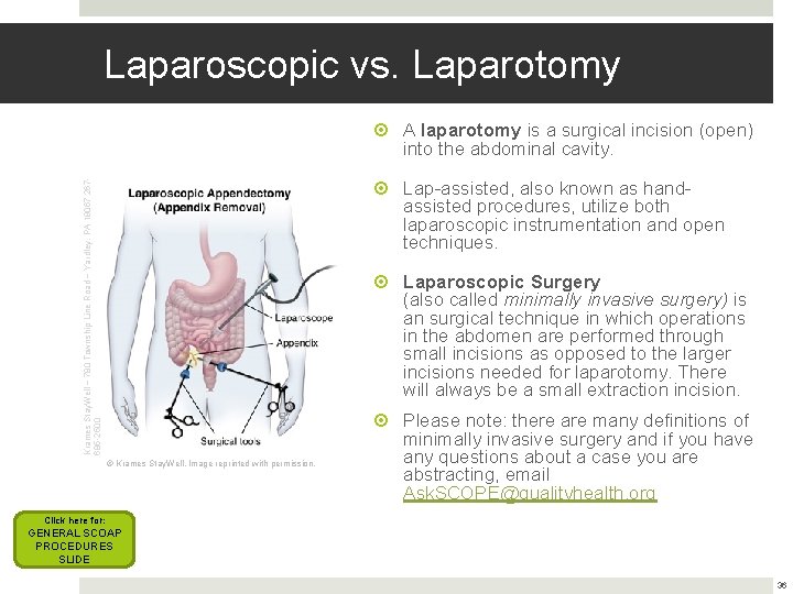 Laparoscopic vs. Laparotomy Krames Stay. Well ~ 780 Township Line Road ~ Yardley, PA Laparoscopic vs. Laparotomy Krames Stay. Well ~ 780 Township Line Road ~ Yardley, PA
