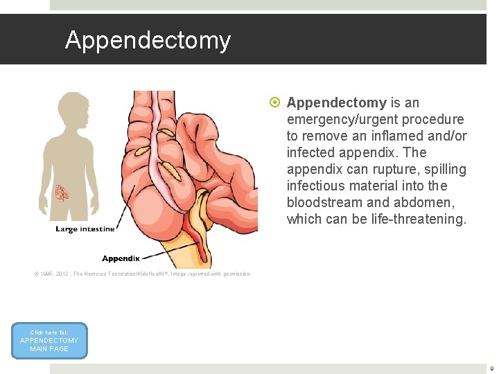 Appendectomy is an emergency/urgent procedure to remove an inflamed and/or infected appendix. The appendix