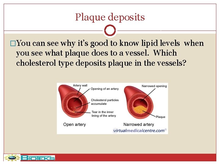 Plaque deposits �You can see why it’s good to know lipid levels when you