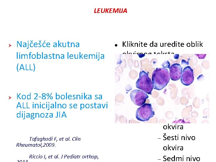 LEUKEMIJA Ø Najčešće akutna limfoblastna leukemija (ALL) Kliknite da uredite oblik okvirnog teksta Drugi LEUKEMIJA Ø Najčešće akutna limfoblastna leukemija (ALL) Kliknite da uredite oblik okvirnog teksta Drugi
