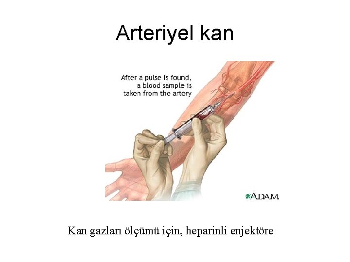 Arteriyel kan Kan gazları ölçümü için, heparinli enjektöre 