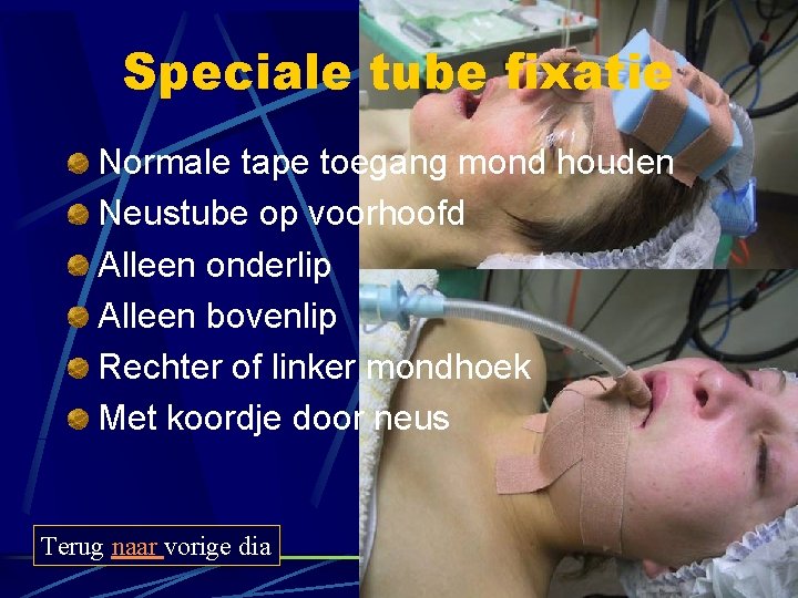 Speciale tube fixatie Normale tape toegang mond houden Neustube op voorhoofd Alleen onderlip Alleen