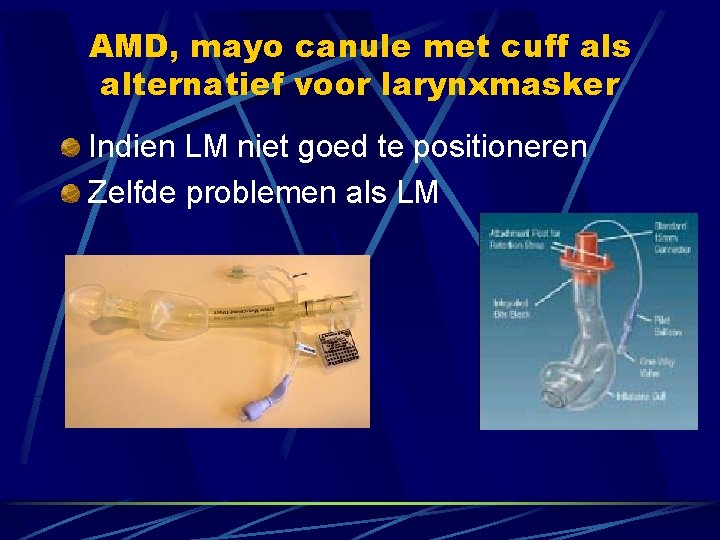 AMD, mayo canule met cuff als alternatief voor larynxmasker Indien LM niet goed te AMD, mayo canule met cuff als alternatief voor larynxmasker Indien LM niet goed te