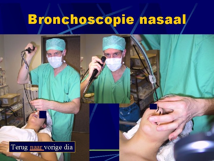 Bronchoscopie nasaal Terug naar vorige dia Bronchoscopie nasaal Terug naar vorige dia