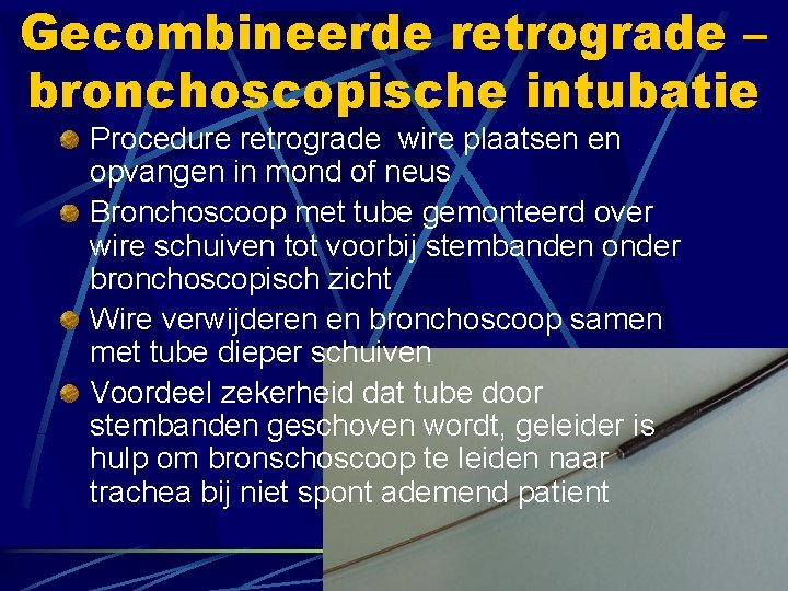 Gecombineerde retrograde – bronchoscopische intubatie Procedure retrograde wire plaatsen en opvangen in mond of